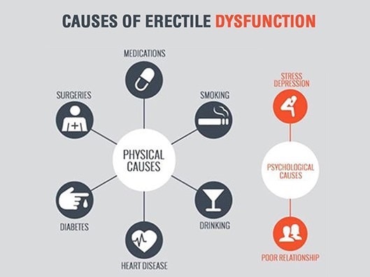 erectile dysfunction causes